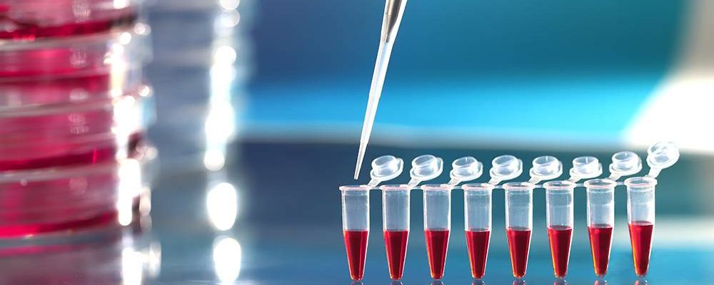 CERMI-Rioja pide pruebas PCR para discapacitados y trabajadores de centros de atención social